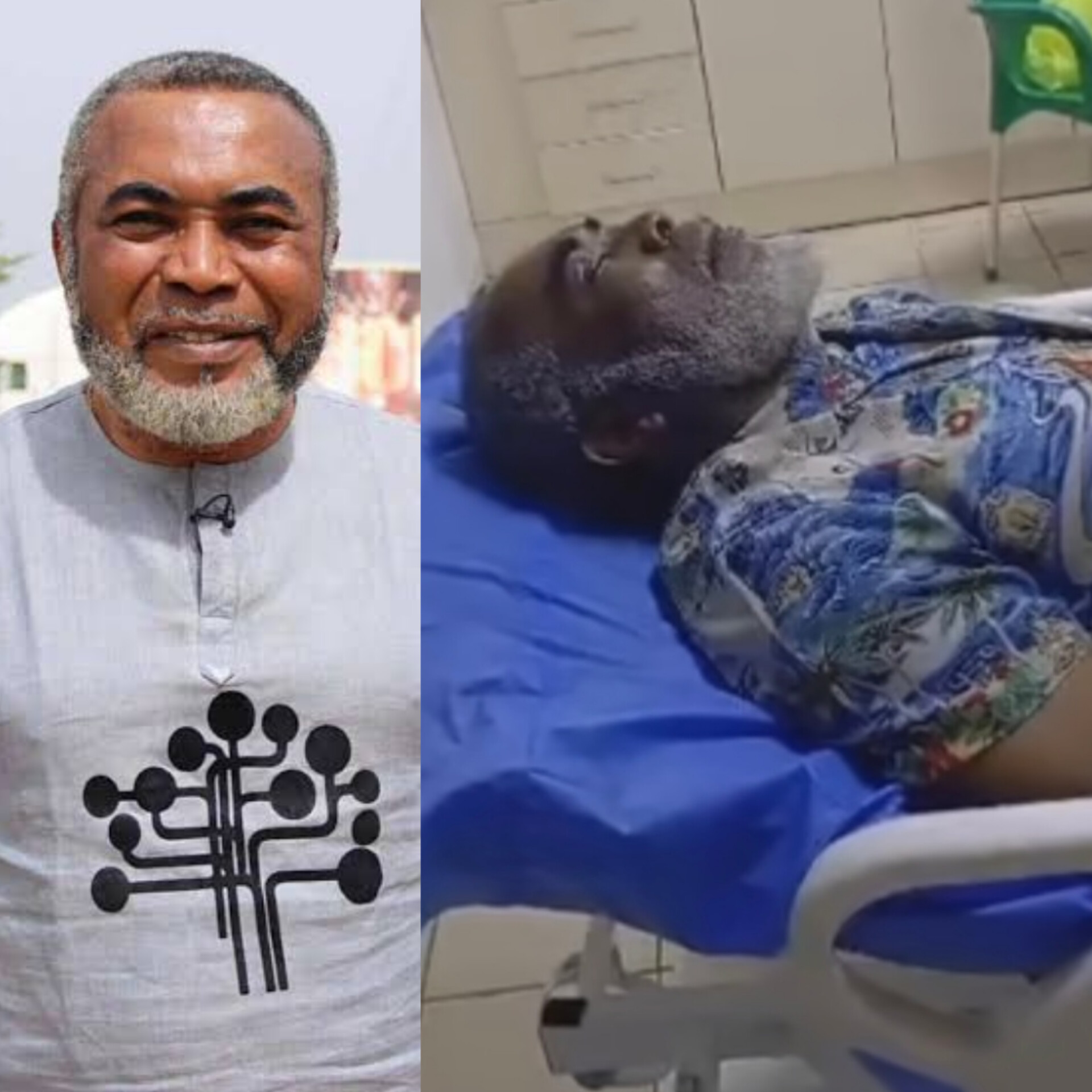 Zack Orji needs support after brain surgery – Minister